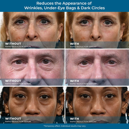 Plexaderm Rapid Reduction Eye Serum - Visibly Reduces Under-Eye Bags, Wrinkles, Dark Circles, Fine Lines & Crow's Feet Instantly, Anti Aging Wrinkle Remover for Face