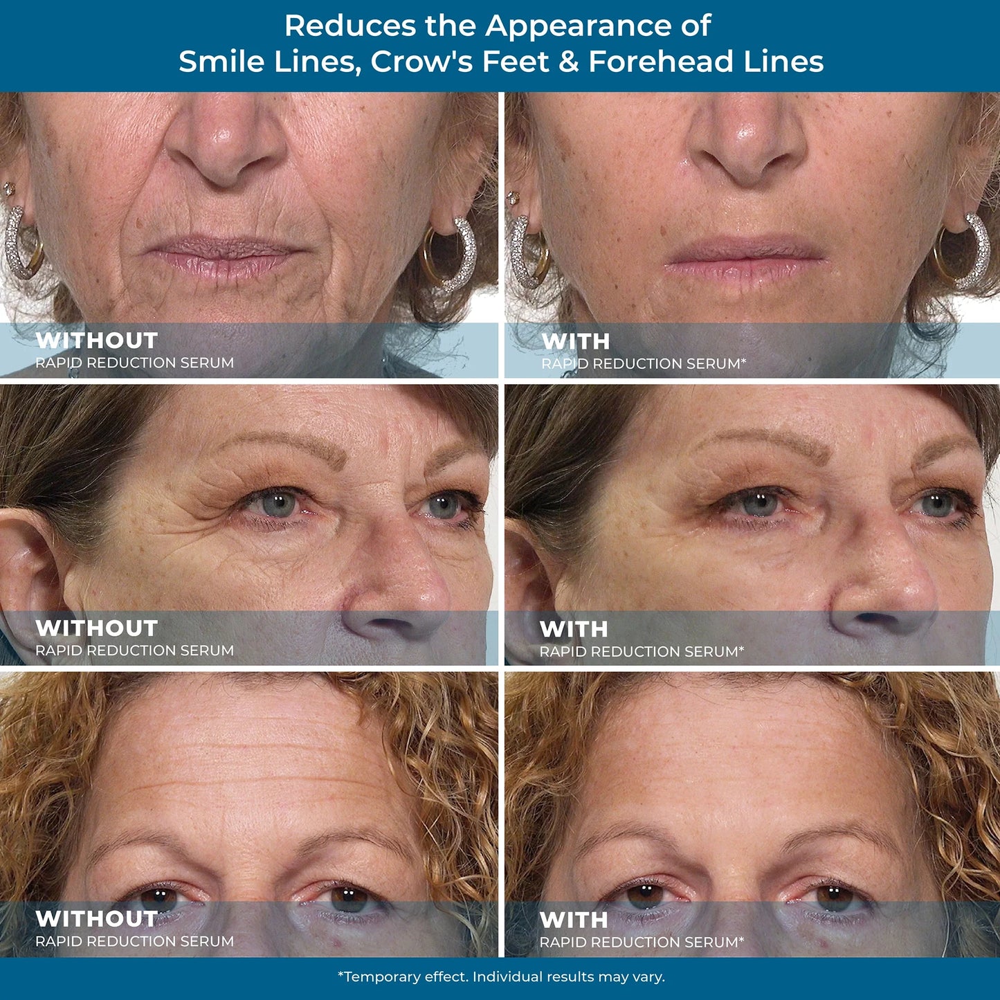 Plexaderm Rapid Reduction Eye Serum - Visibly Reduces Under-Eye Bags, Wrinkles, Dark Circles, Fine Lines & Crow's Feet Instantly, Anti Aging Wrinkle Remover for Face