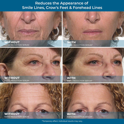Plexaderm Rapid Reduction Eye Serum - Visibly Reduces Under-Eye Bags, Wrinkles, Dark Circles, Fine Lines & Crow's Feet Instantly, Anti Aging Wrinkle Remover for Face